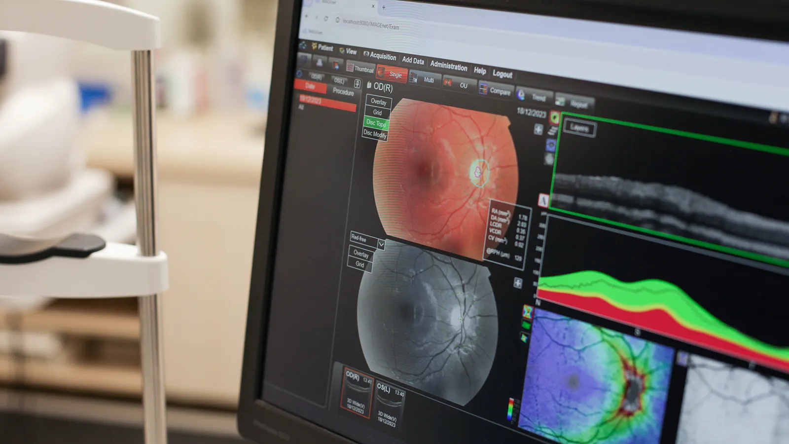 Optical Coherence Tomography (OCT) Visique Optometrists Hutt Valley